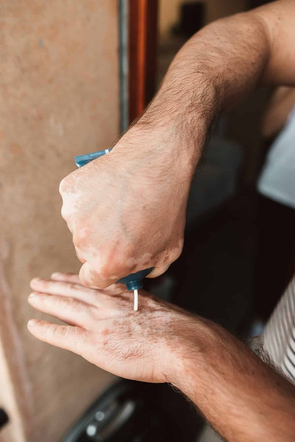 Centre lasers dermatologiques à lyon : expertise et sécurité